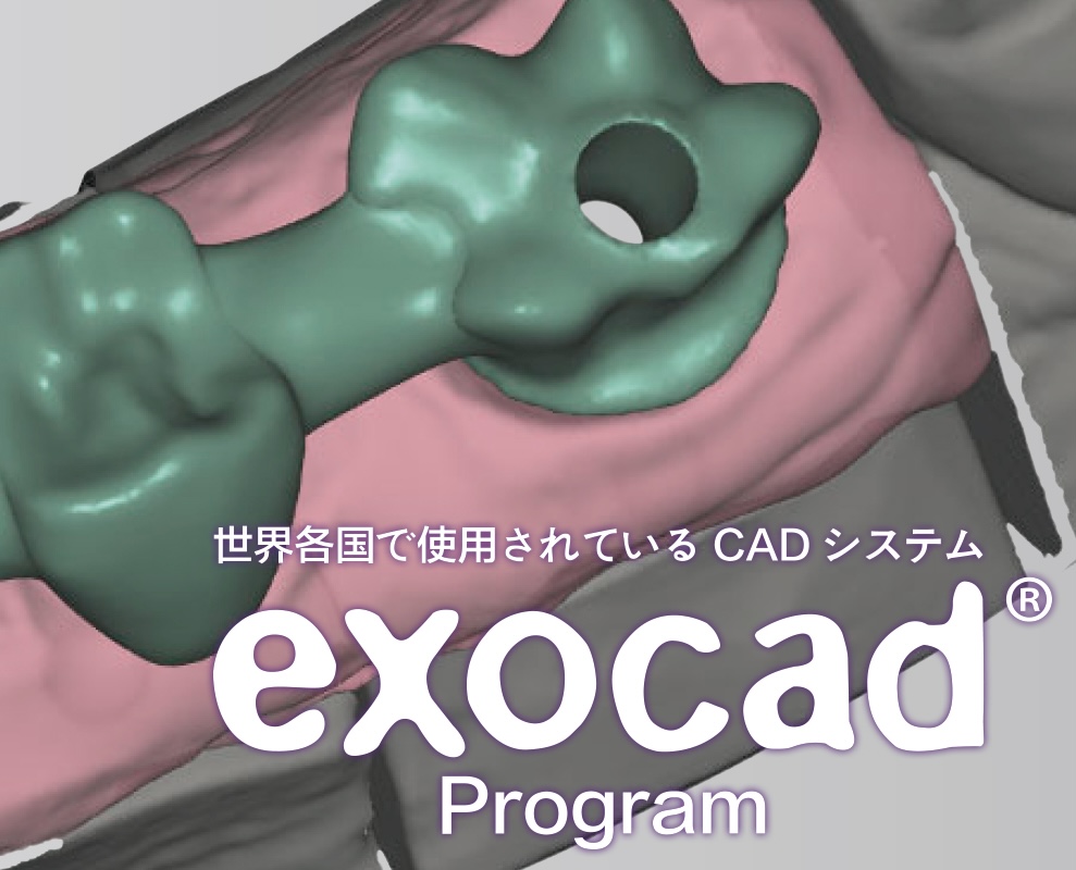 exocad 3.1/3.2